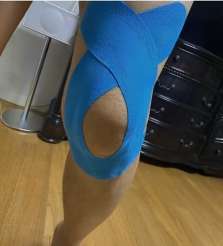 Customer photo review of TAPEX™ Kniegelenk inkl. Löse Spray (60ml)