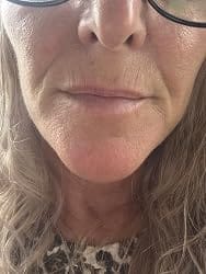 Customer photo review of Collagen Multi Balm Stick