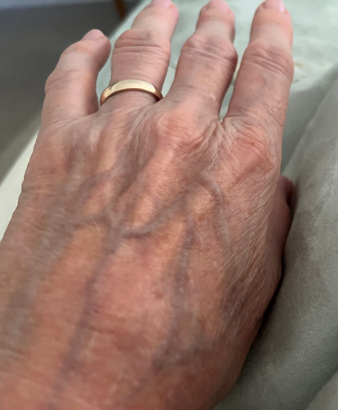 Customer photo review of 30 Days Of Age Defying Multi-Collagen