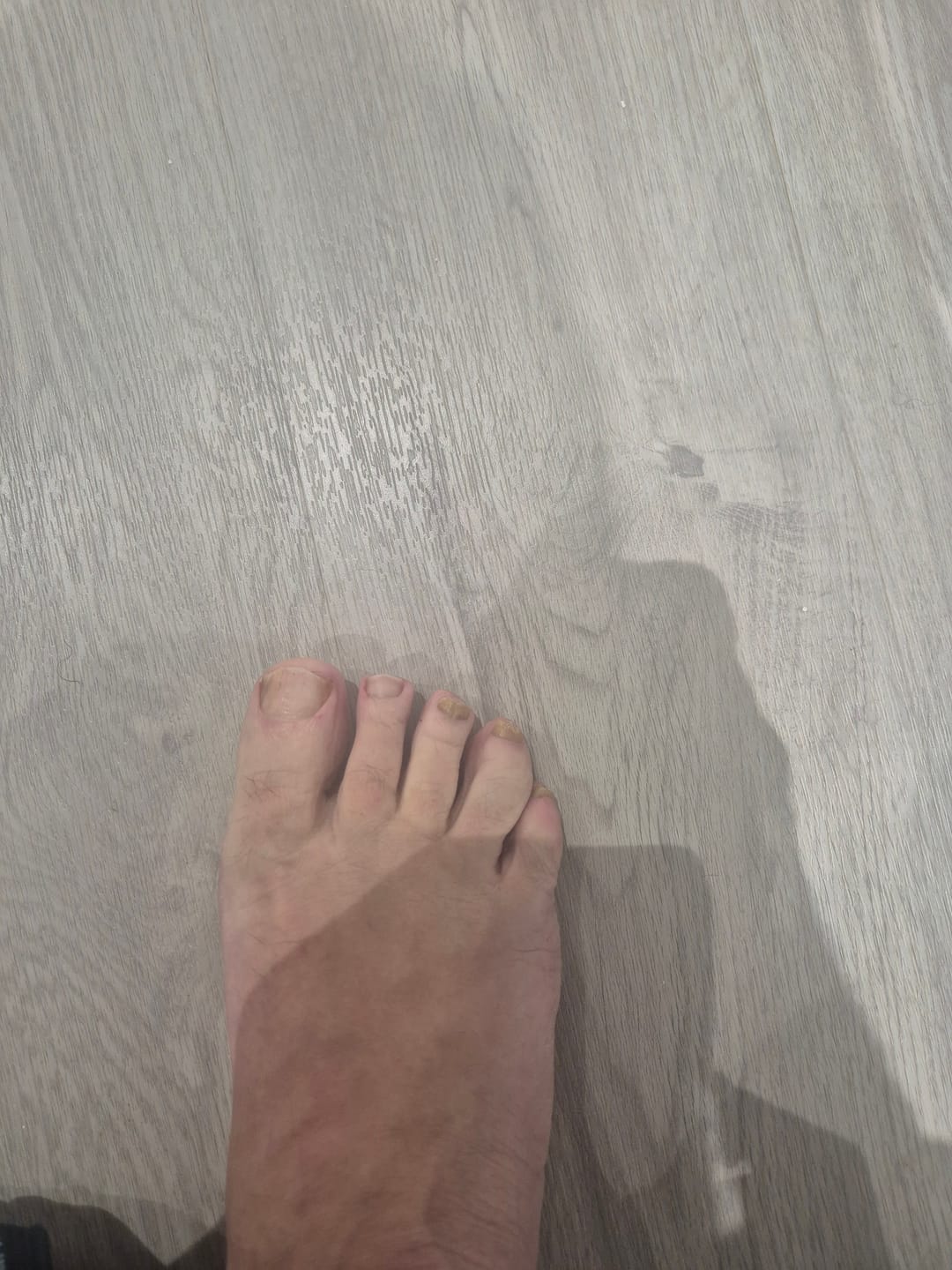 Customer photo review of Fungal Freedom
