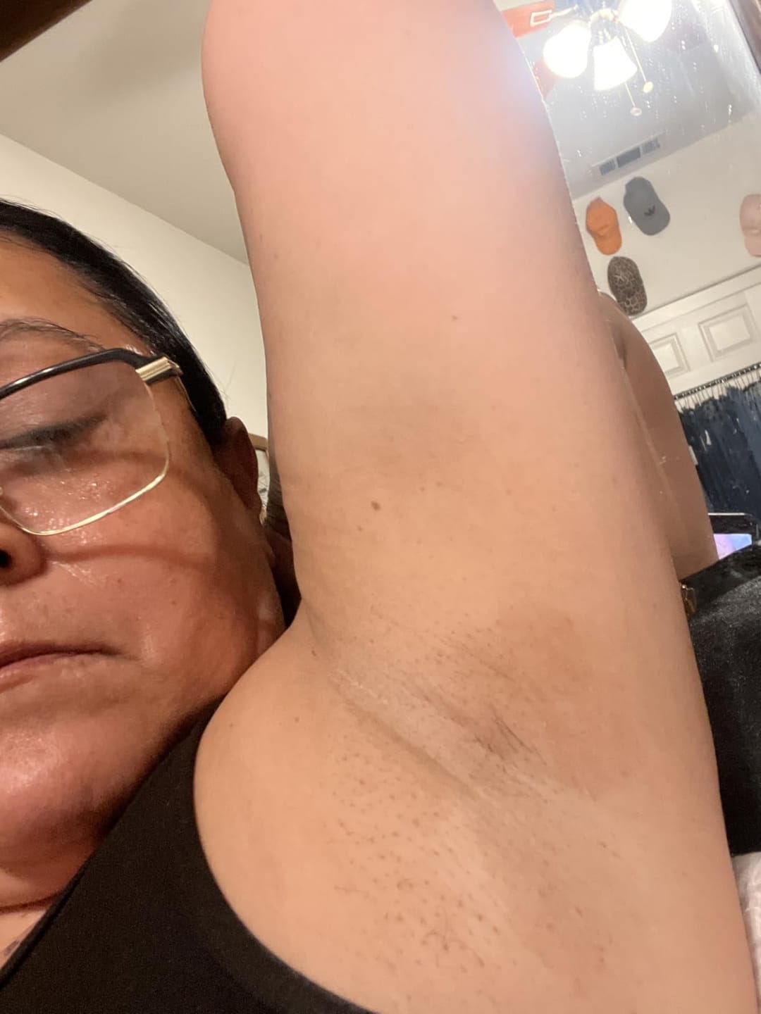 Customer photo review of Peel Shot Kojic Acid Turmeric Spray