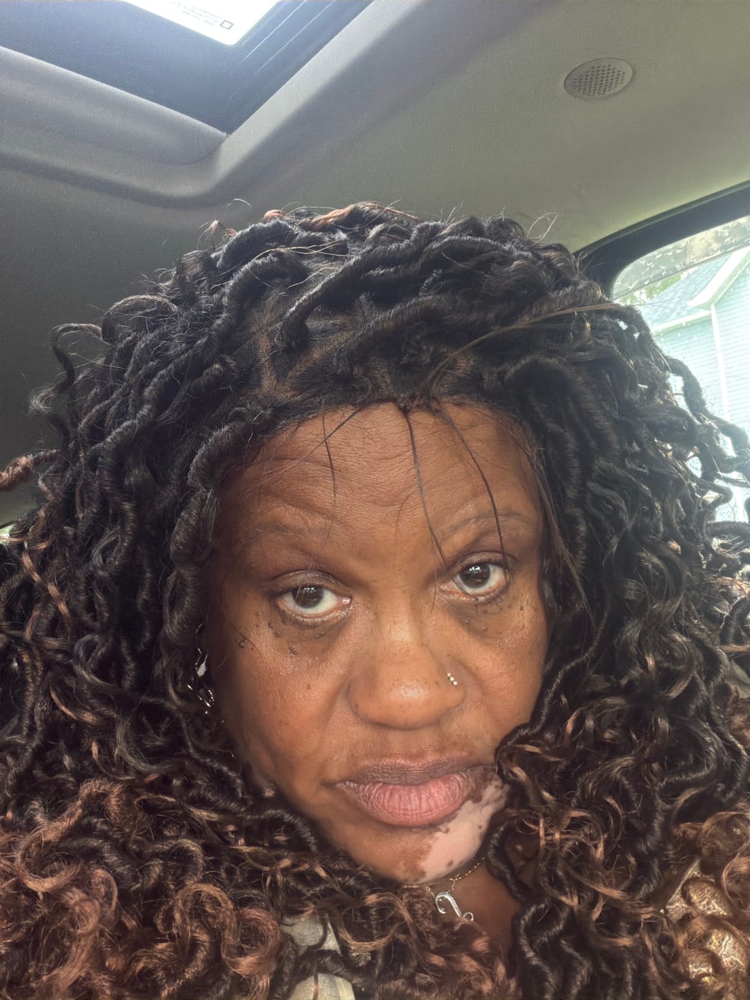 Customer photo review of PCOS RELIEF