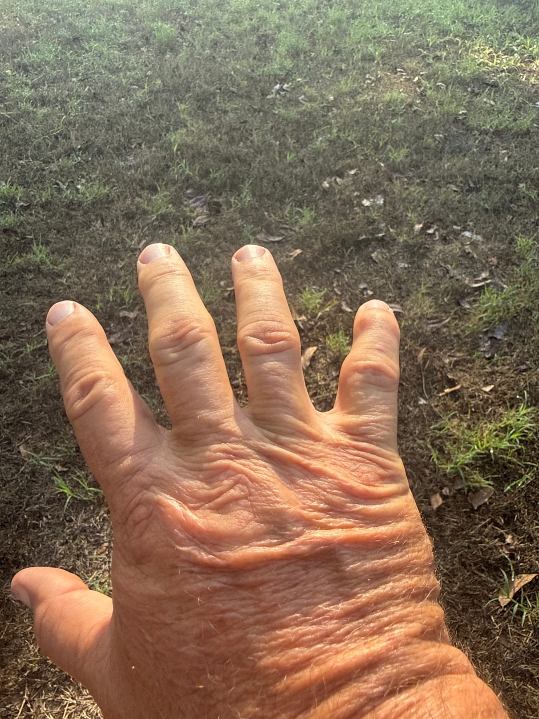 Customer photo review of OverSize - XCONTROL Half Set (7 grips)