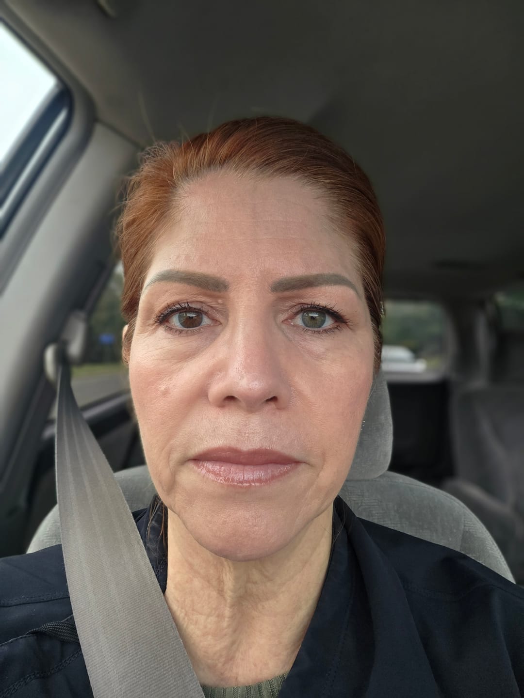 Customer photo review of ACTIVE PRO SERUM | ANTI-AGING