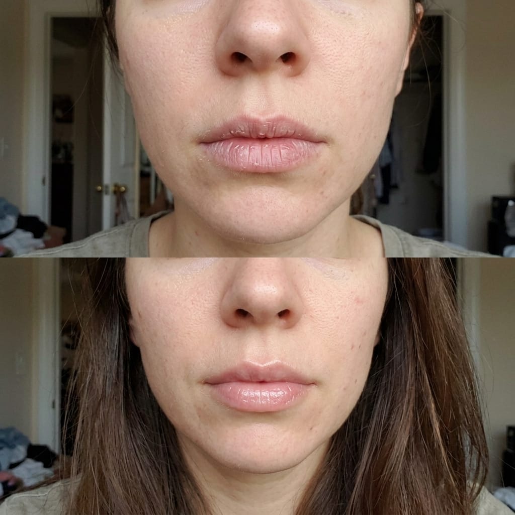 Customer photo review of Korean  Lip-Peel-Off Mask