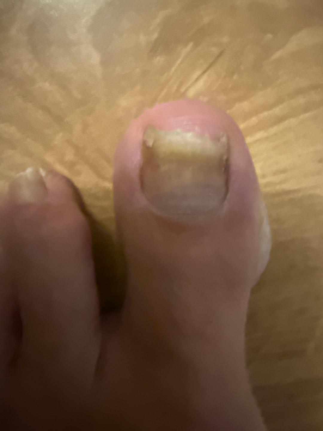 Customer photo review of Fungal Freedom