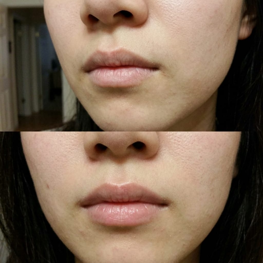 Customer photo review of Korean  Lip-Peel-Off Mask