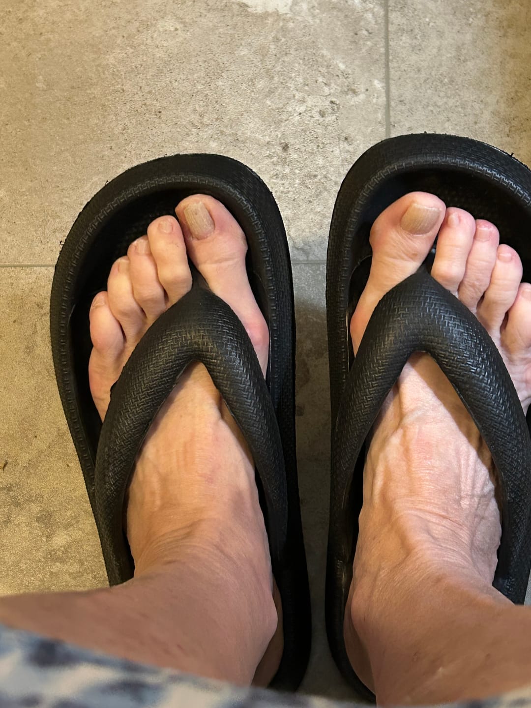 Customer photo review of Cloud Slides - Original Cushion Comfort