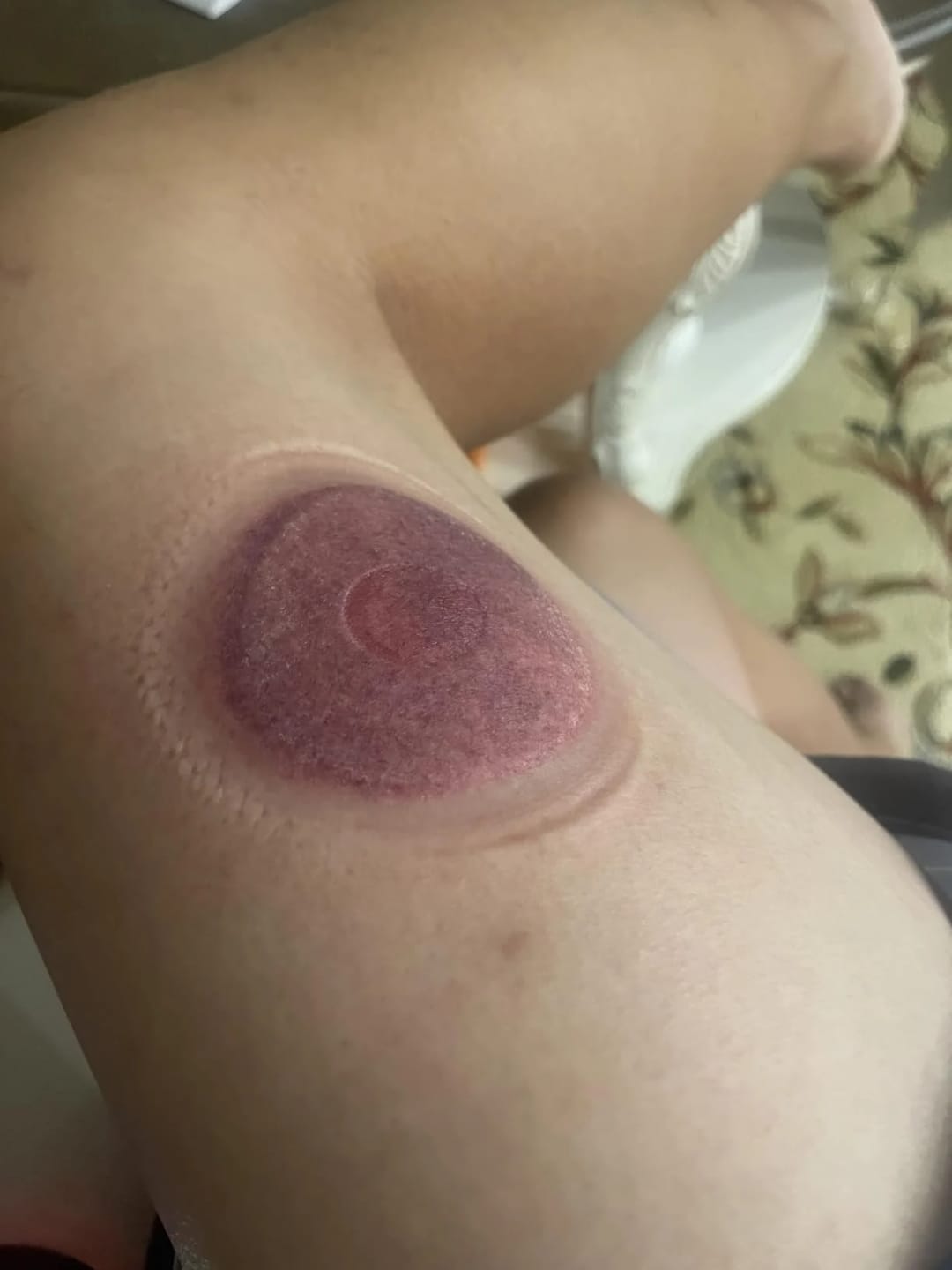 Customer photo review of Cupsy Izomlazító