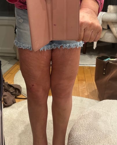 Customer photo review of NØRD BODY Anti-Cellulite Massage Oil
