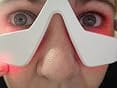 Customer photo review of Lumera Pro - Red Light Therapy + EMS To Erase Eye Bags