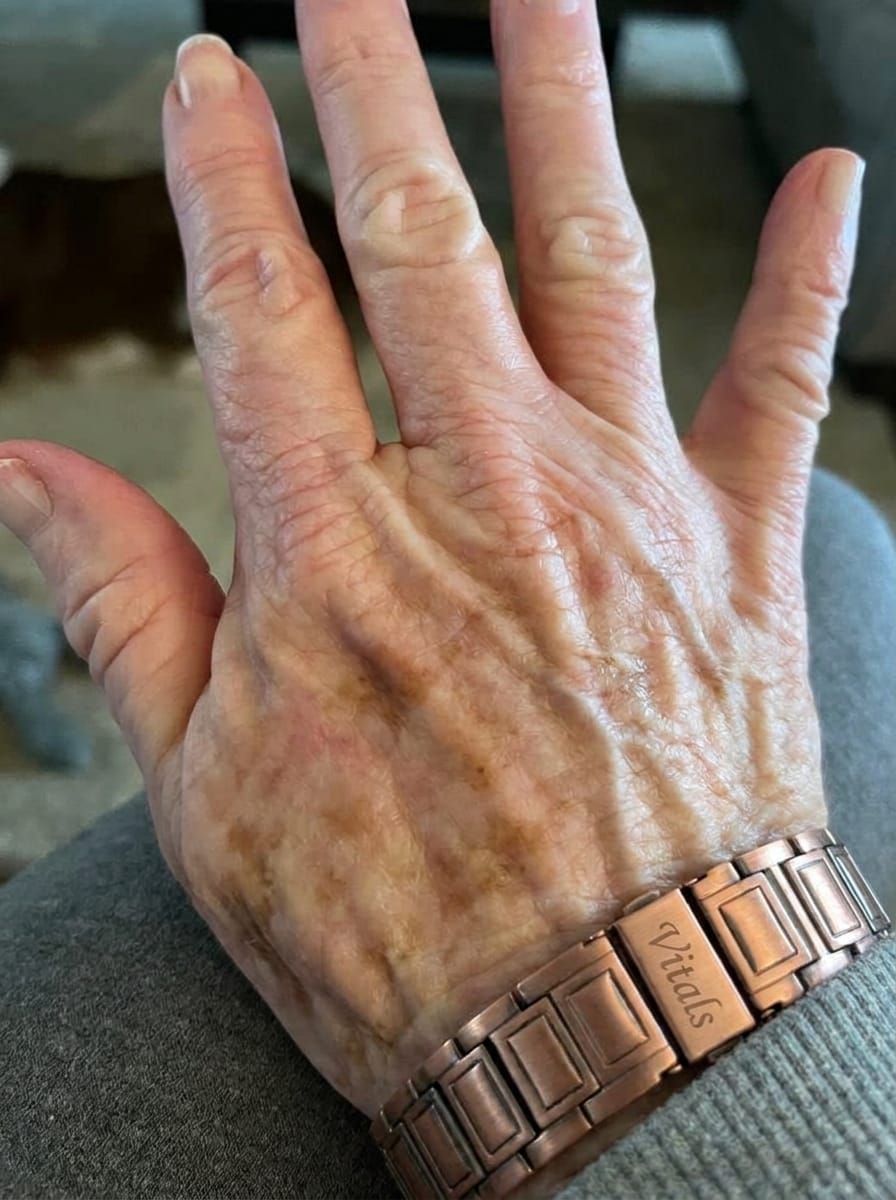 Customer photo review of Copper Bracelet
