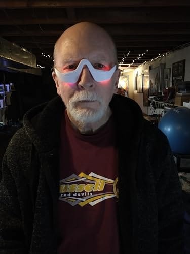 Customer photo review of Lumera Pro - Red Light Therapy + EMS To Erase Eye Bags