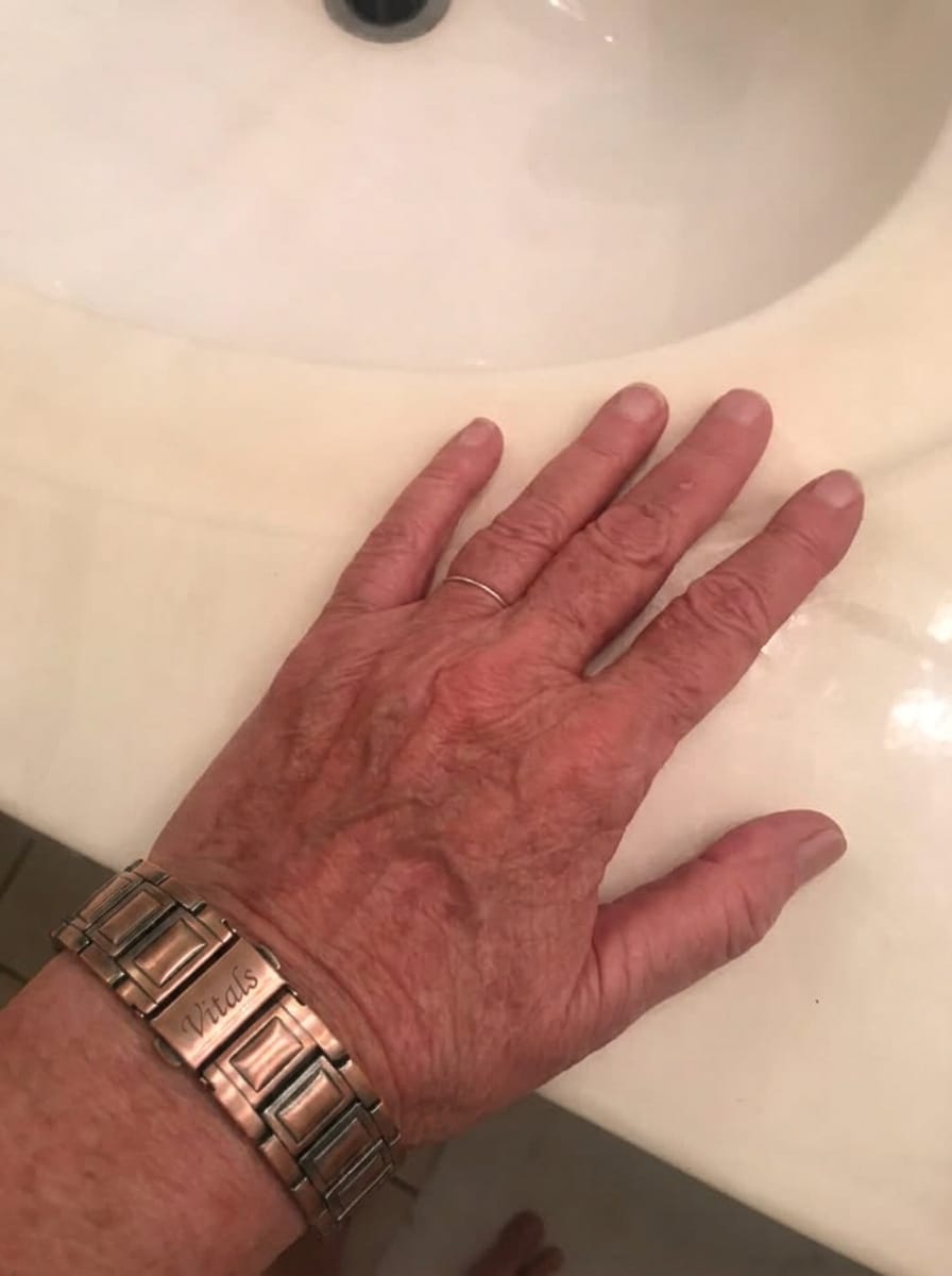 Customer photo review of Copper Bracelet