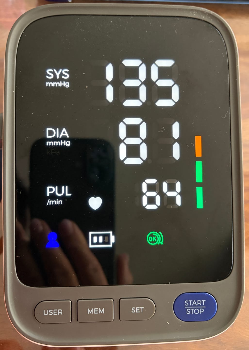 Customer photo review of Blutdruckmessgerät V8 Ultra – Next-Gen Präzisionssensor für klinisch genaue Messungen