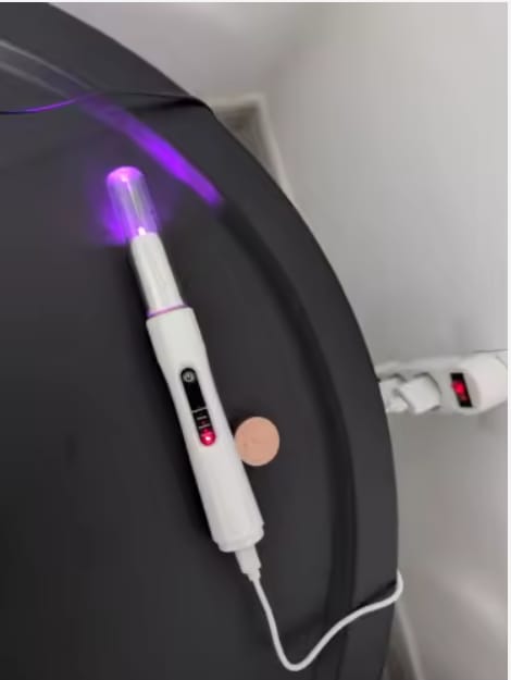 Customer photo review of Bright Bite™ — Pet Dental Cleaner