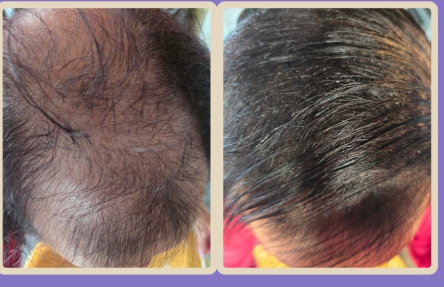 Customer photo review of Ansatzpuder Starter-Set (Ansatzpuder, Ansatzpuder Pinsel, Finishing Spray)