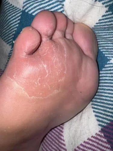Customer photo review of SAFLORA® Arındırıcı Bakım Sabunu – Çay Ağacı, Okaliptüs ve Kükürt