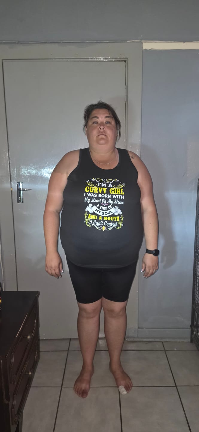 Customer photo review of CheetaThin® Weight Management - Buy 2 Get 2 Free, Free Access to Exit Plan + Win R5,000 Challenge