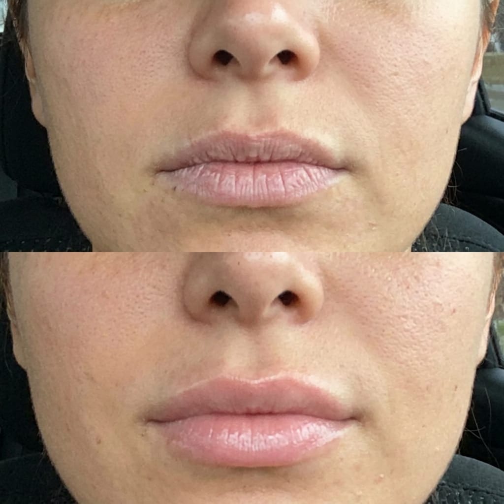 Customer photo review of Korean  Lip-Peel-Off Mask