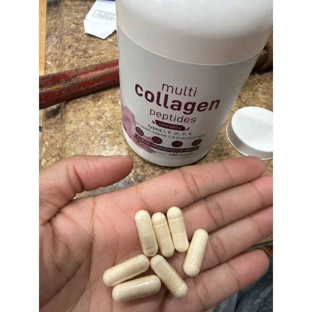 Customer photo review of Multi Collagen Complex for Women – 240 Capsules with Biotin
