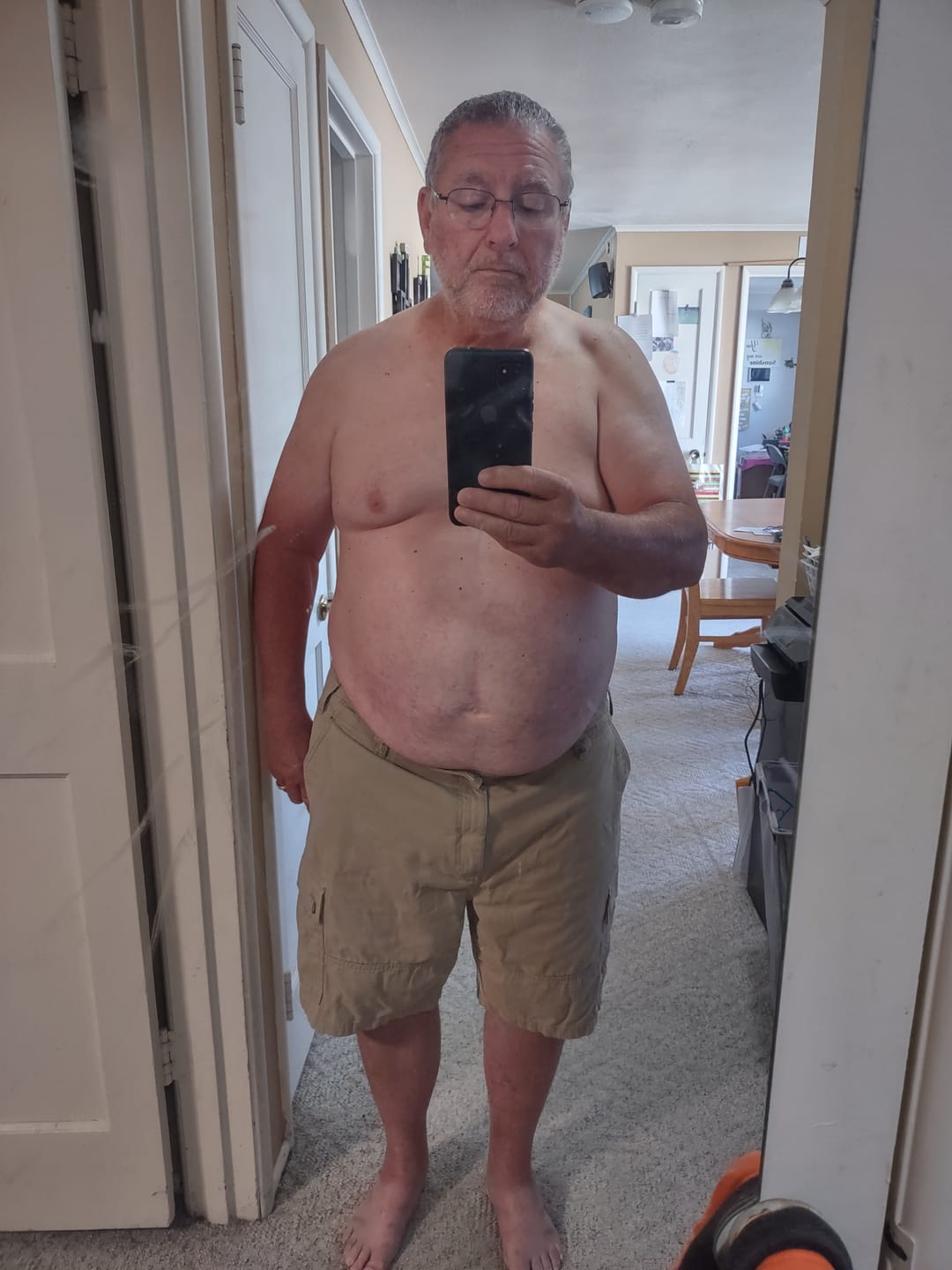 Customer photo review of Stackable Resistance Bands Set