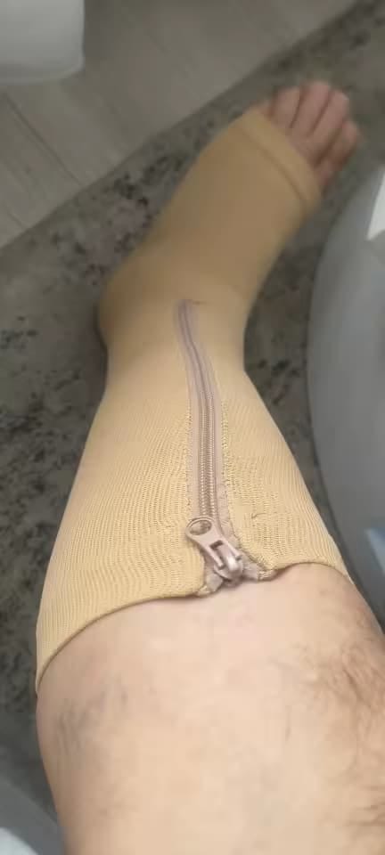 Customer photo review of Bas de Contention Zippé | Alignéo Boutique™