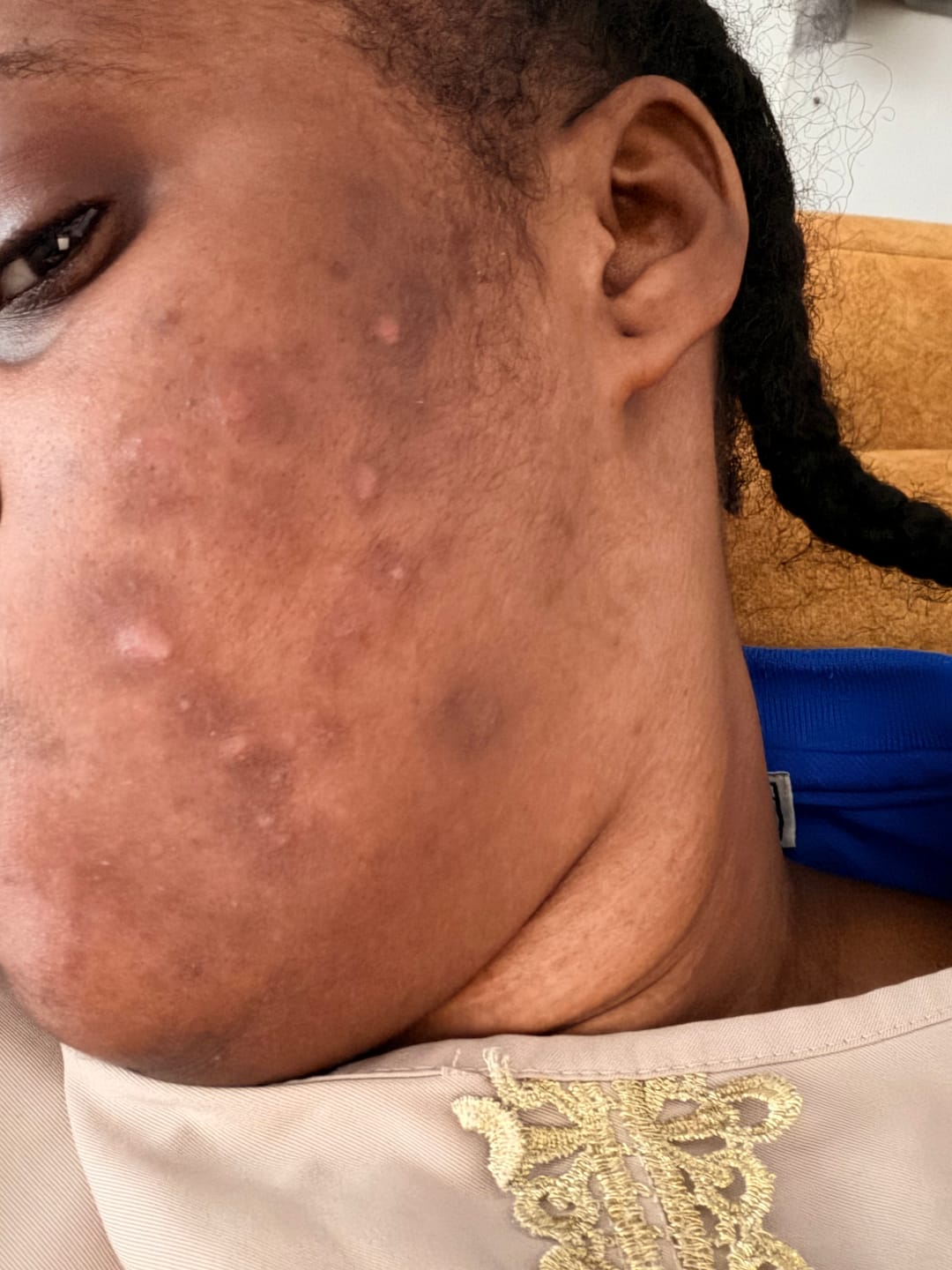 Customer photo review of Sérum Anti-Imperfections