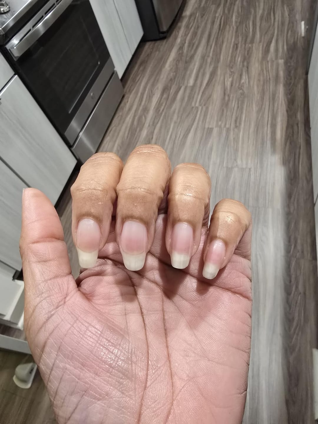 Customer photo review of Multi Collagen Complex for Women – 240 Capsules with Biotin