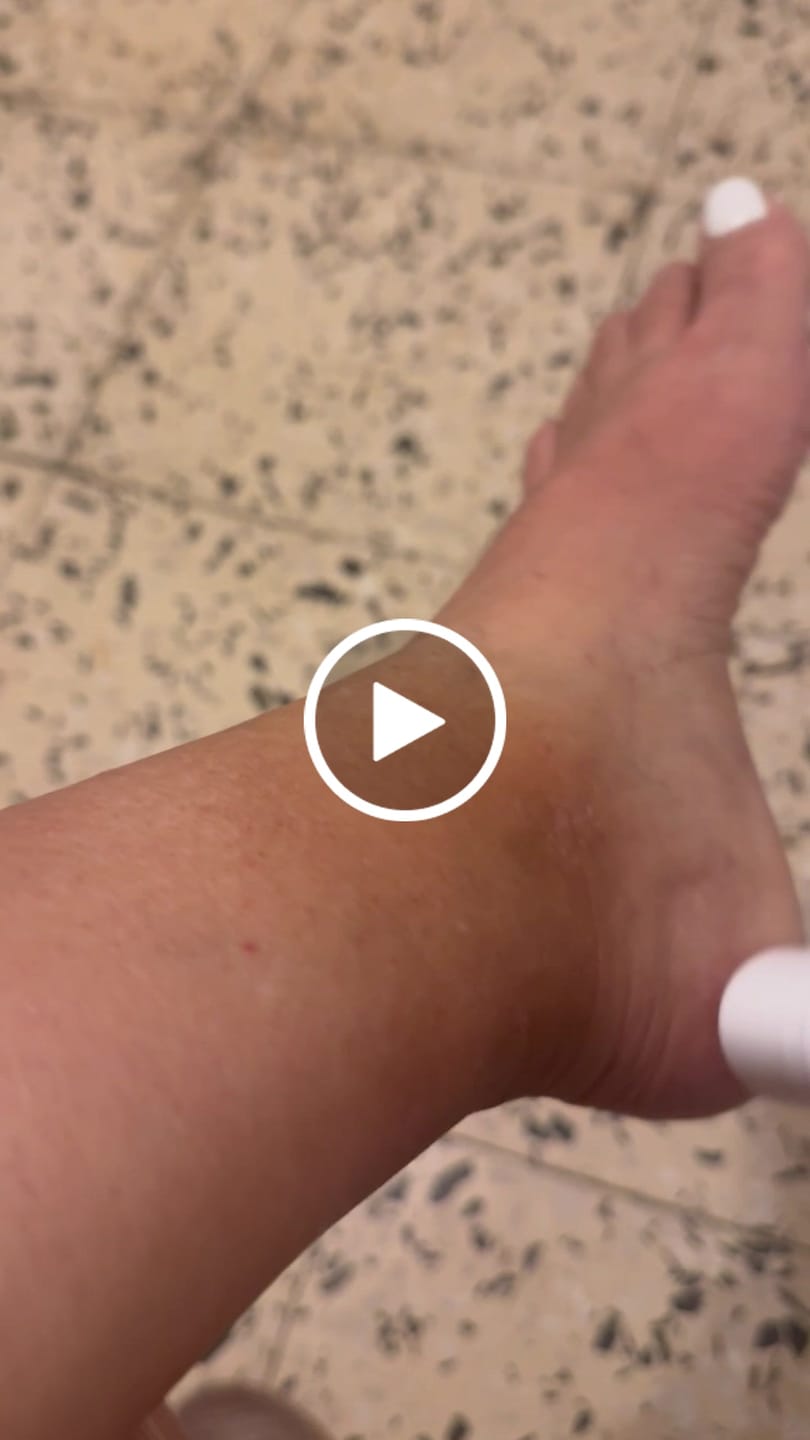 Customer video review of Foot Balm