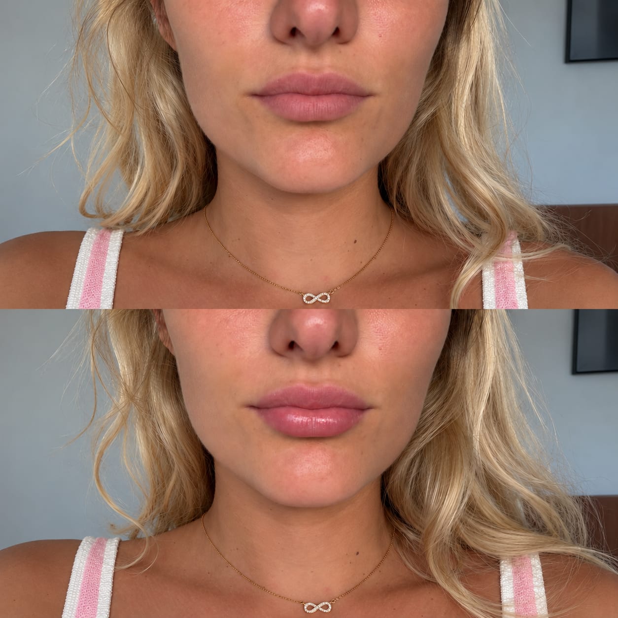 Customer photo review of Korean  Lip-Peel-Off Mask