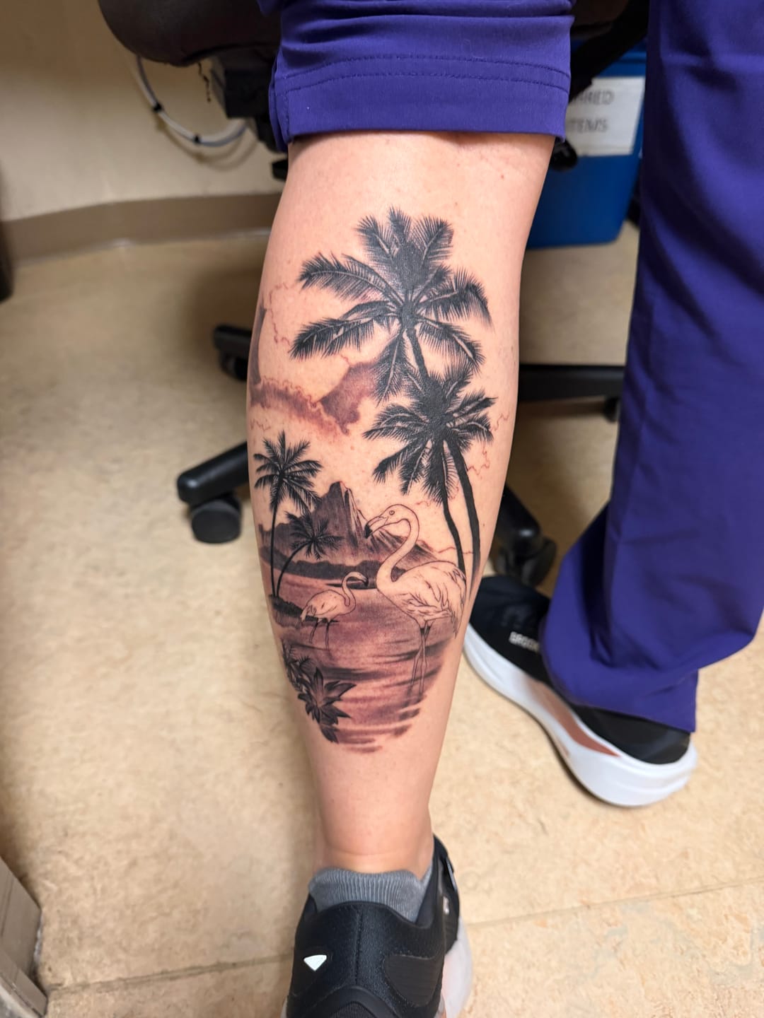 Customer photo review of Signature Tattoo Numbing Cream 1 TUBE