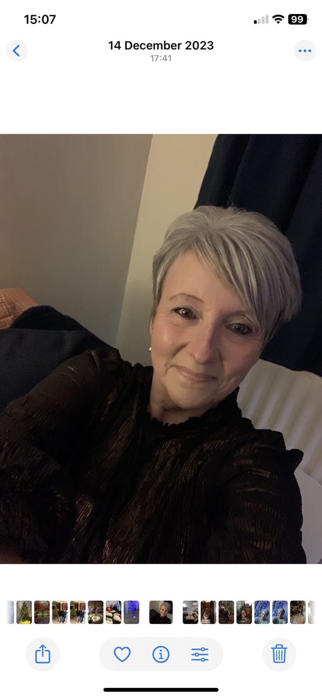 Customer photo review of Rosalique 3 in 1 Anti-Redness Miracle Formula SPF50