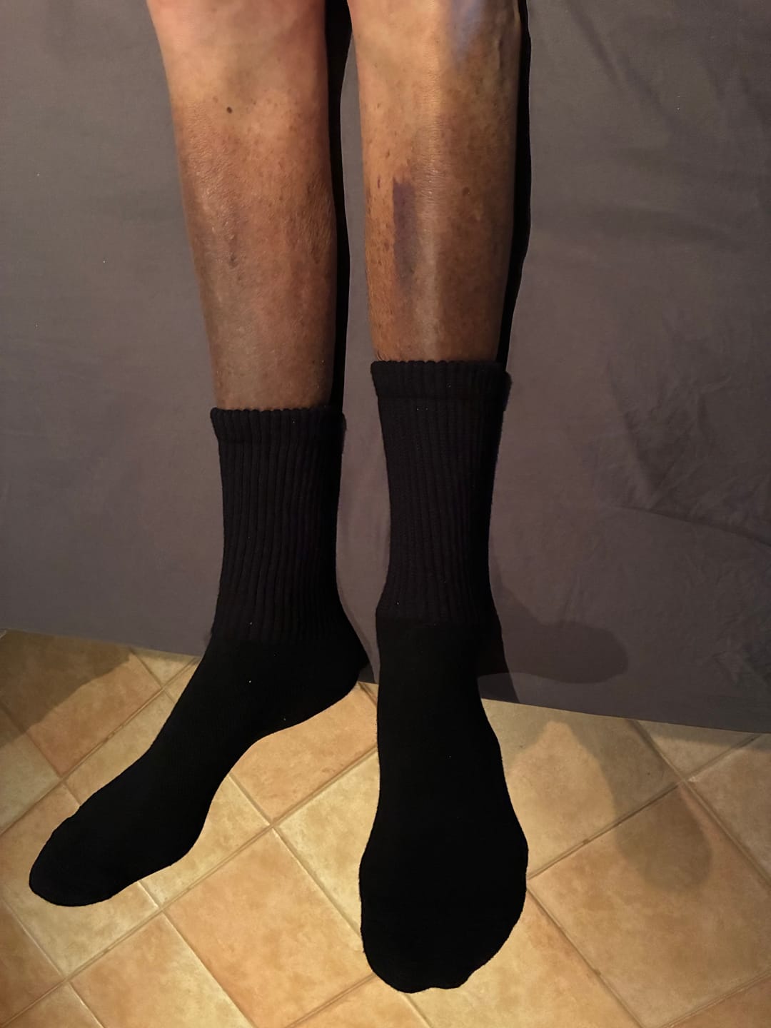Customer photo review of Lightfeet Diabetes - Crew Socks