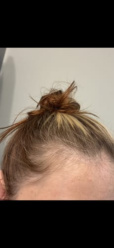 Customer photo review of TR Hair Oil Essentials Bundle ($66 value)