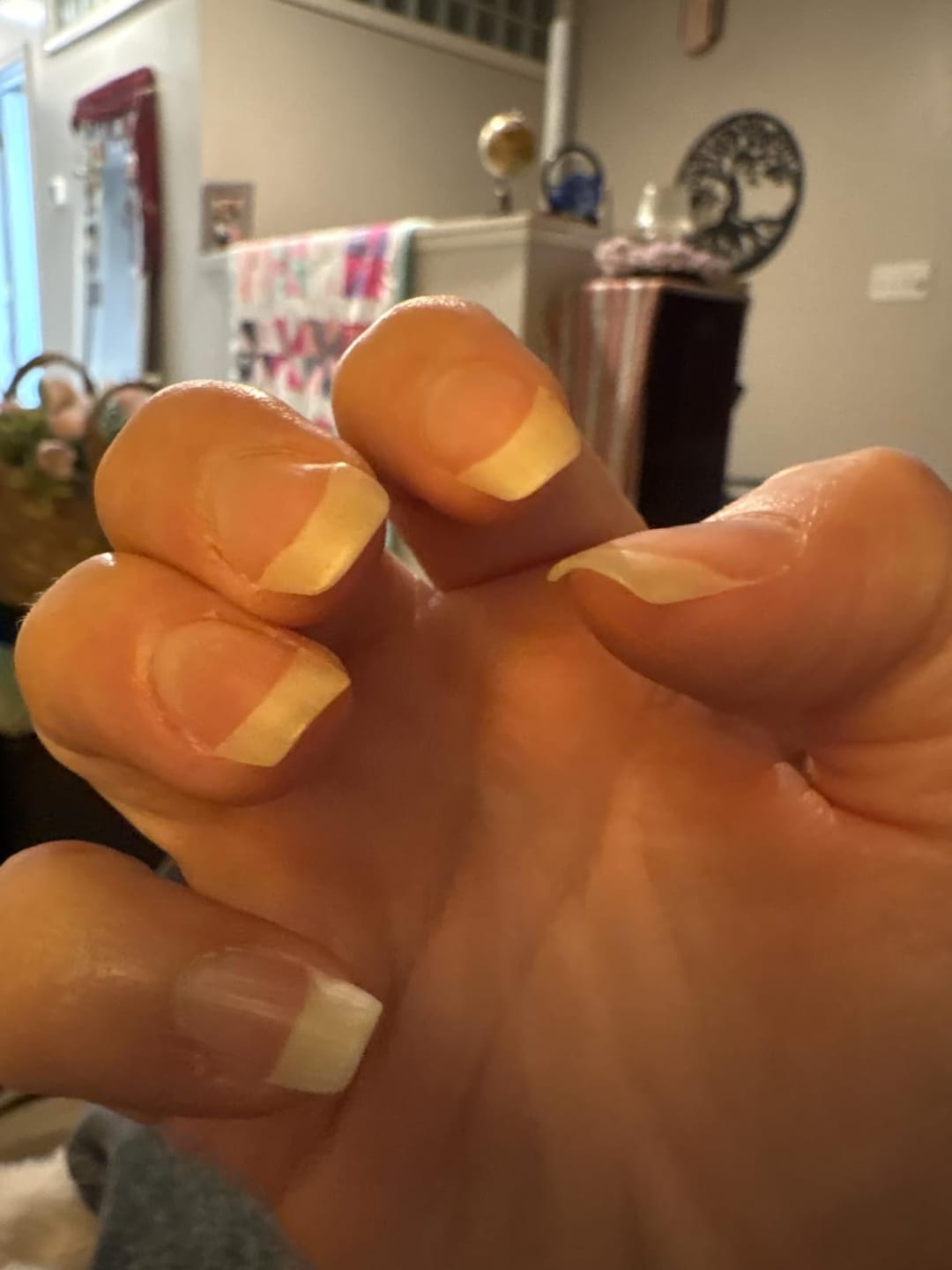 Customer photo review of Multi Collagen Complex for Women – 240 Capsules with Biotin