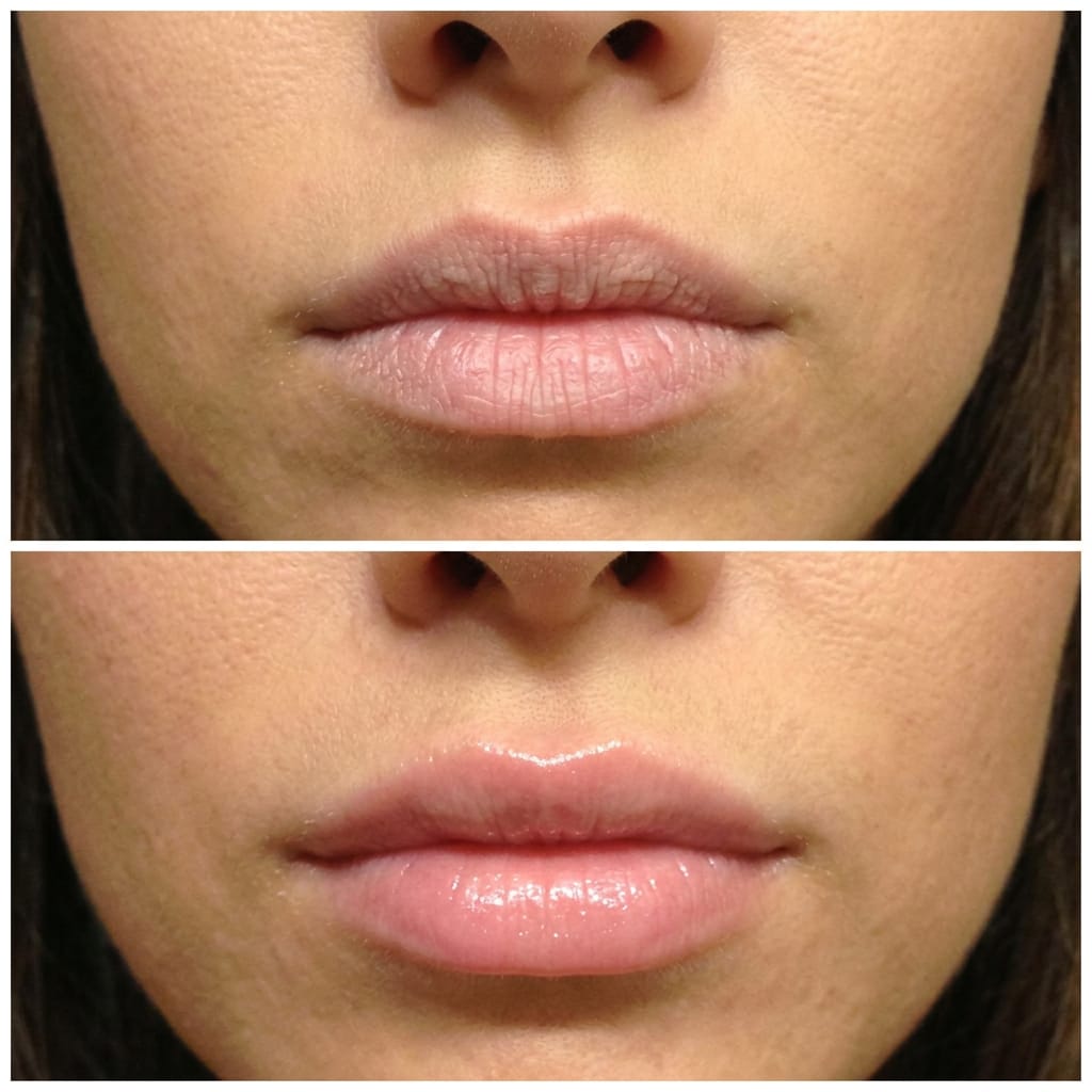 Customer photo review of Korean  Lip-Peel-Off Mask