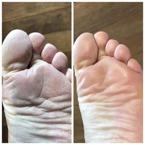 Customer photo review of SAFLORA® Arındırıcı Bakım Sabunu – Çay Ağacı, Okaliptüs ve Kükürt