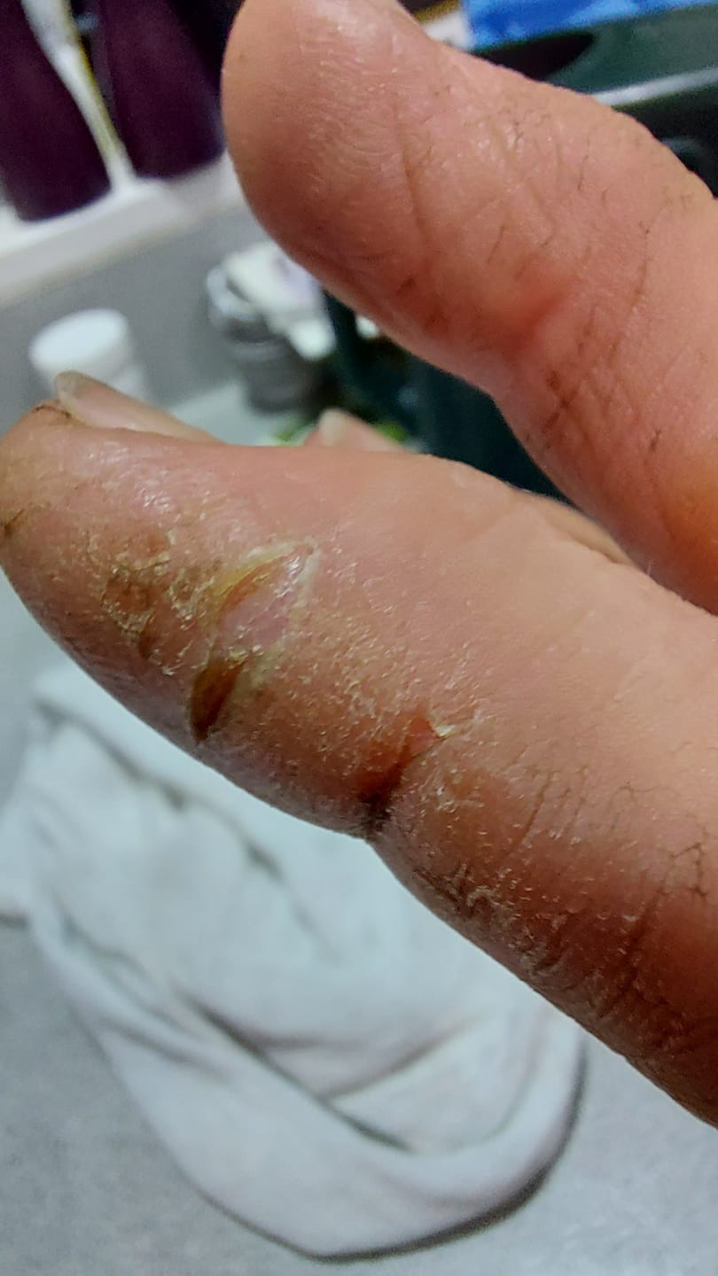 Customer photo review of Kawakawa Balm