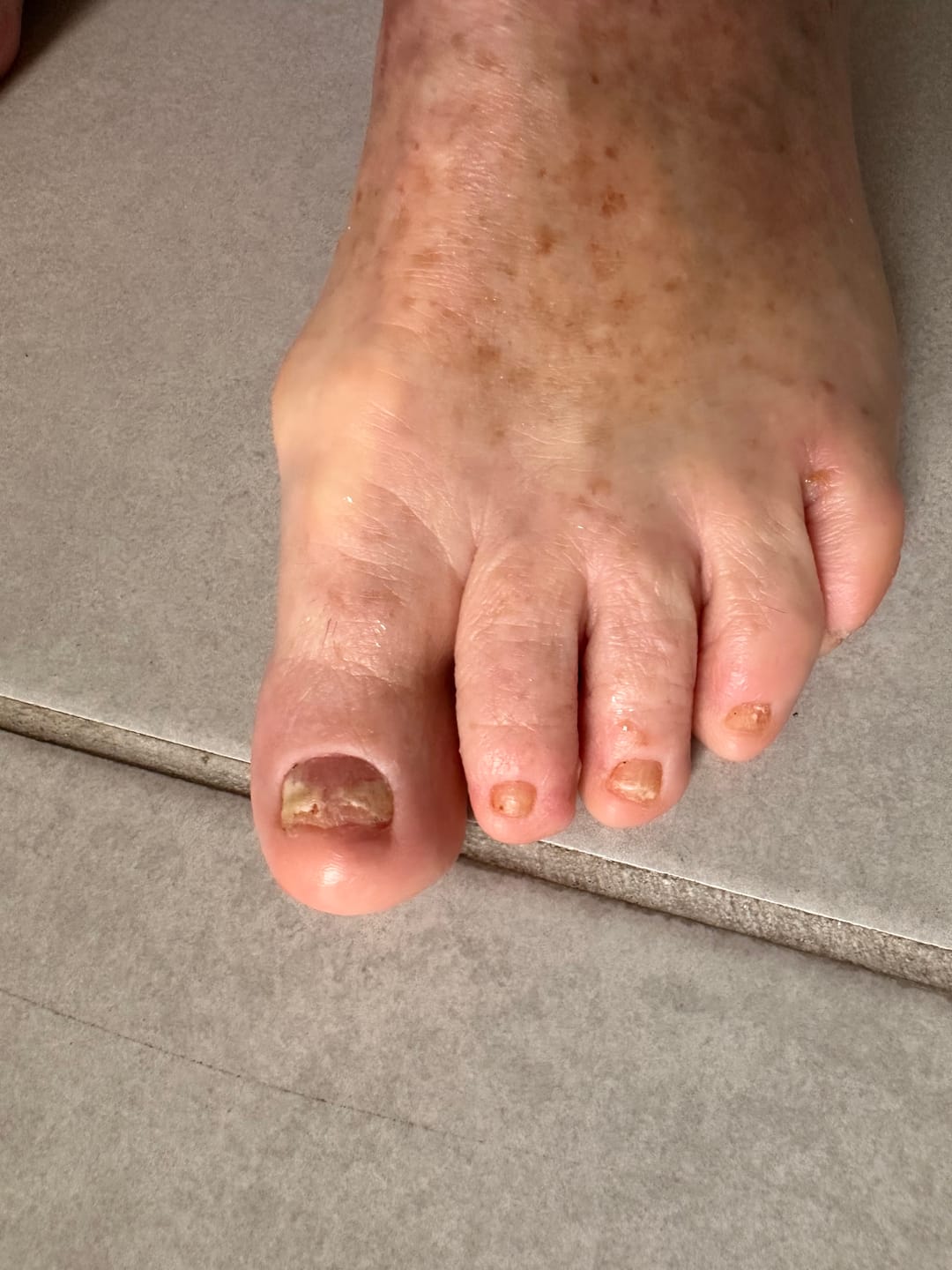 Customer photo review of Fungal Freedom