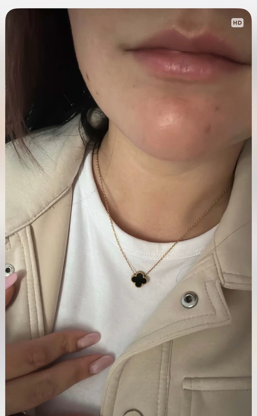 Customer photo review of Lantisor Flower Negru
