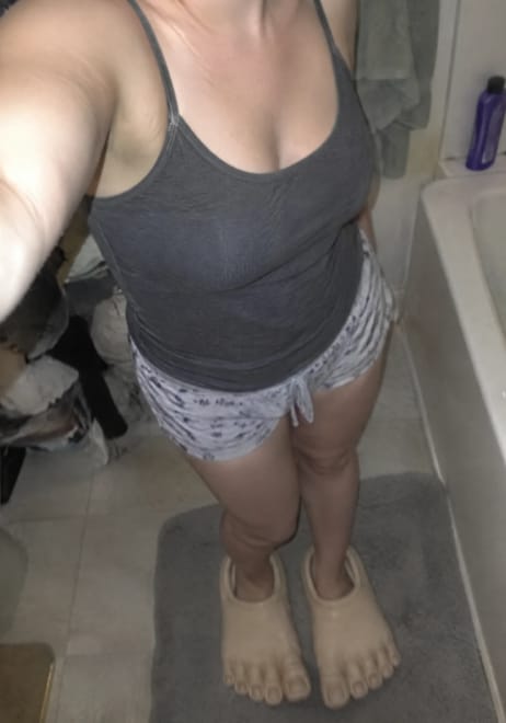 Customer photo review of GoofyFeet