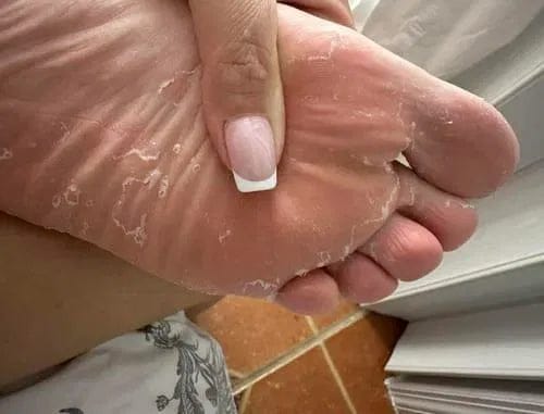 Customer photo review of SAFLORA® Arındırıcı Bakım Sabunu – Çay Ağacı, Okaliptüs ve Kükürt