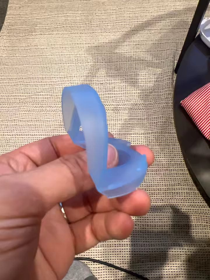 Customer photo review of Orthèse Anti-Ronflement Vantyx™