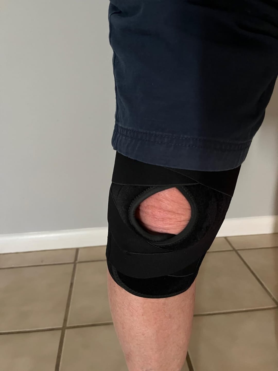 Customer photo review of Knee Pad