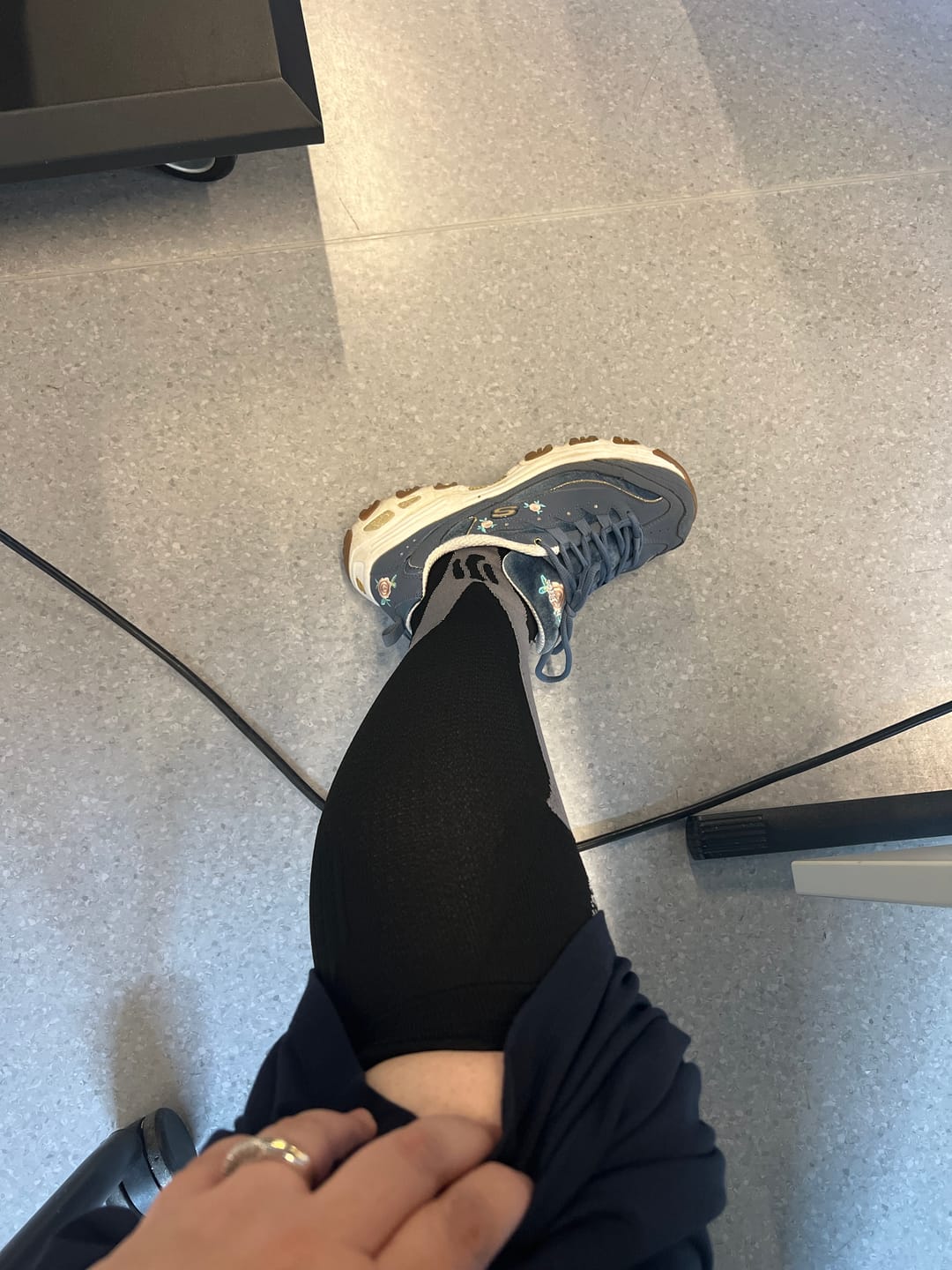 Customer photo review of Günlük Kullanım İçin Destekleyici Kompresyon Çorabı