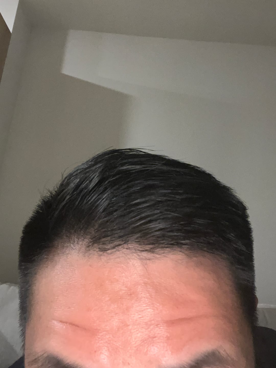 Customer photo review of (Almost Out of Stock) Hair Styling Powder