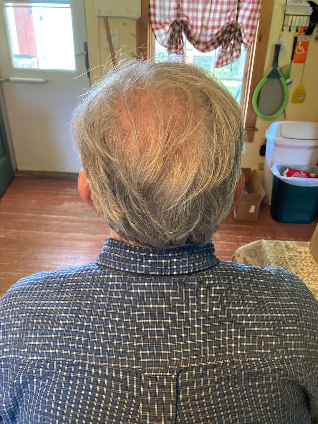 Customer photo review of Herbal Hair Growth Shampoo