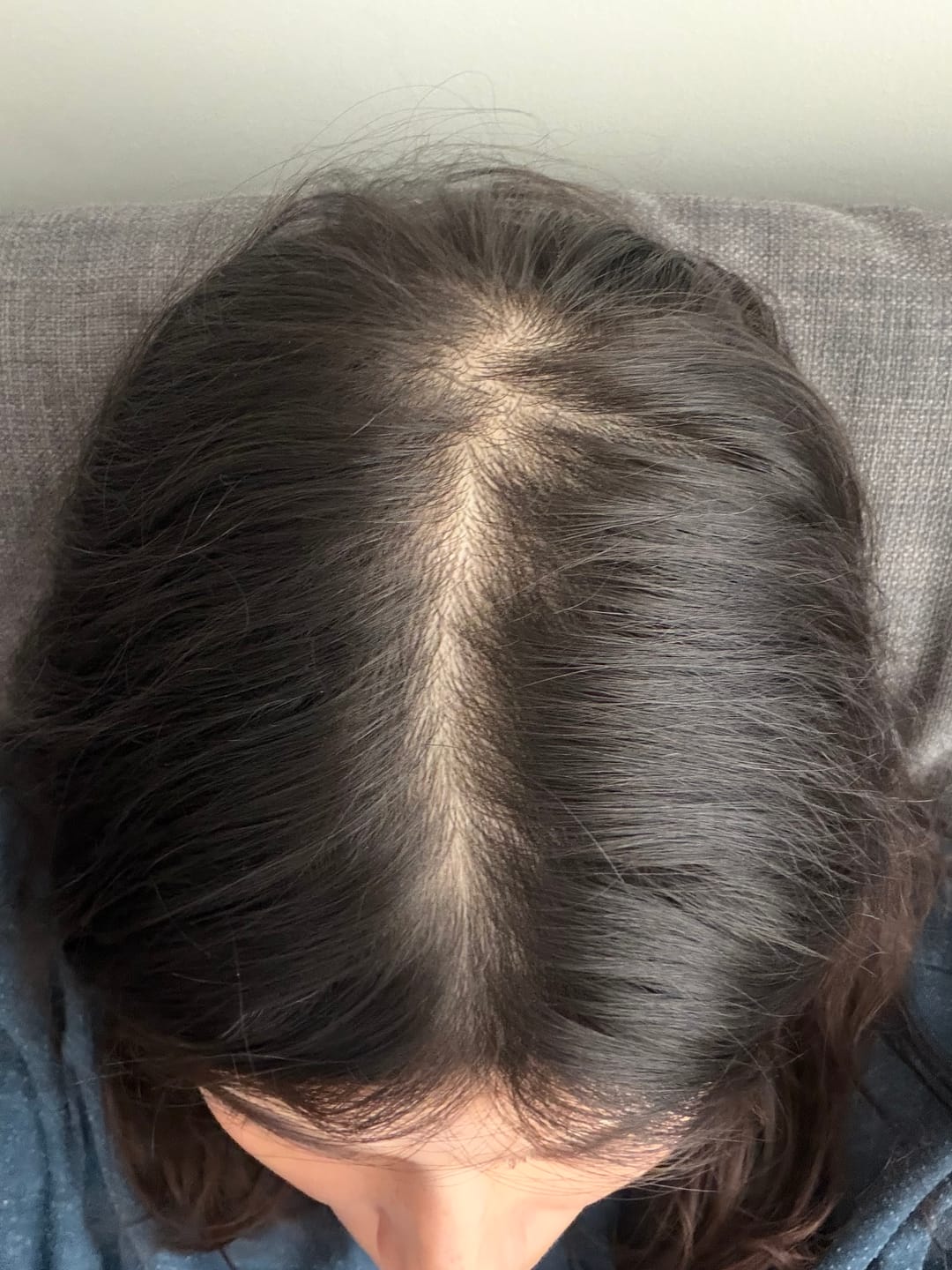 Customer photo review of VITAFOAM ™ Hair Growth Formula