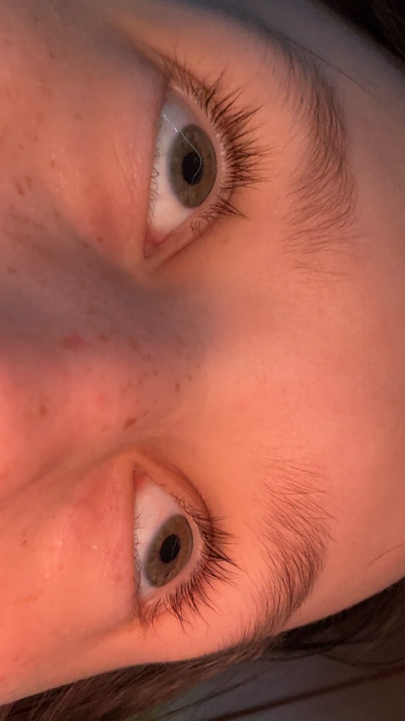 Customer photo review of Lash Serum | INTENSE